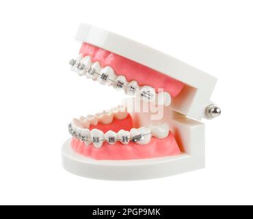 Teeth model with metal wire dental braces or dental instruments isolated on white background, Save clipping path. Stock Photo