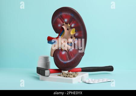 Kidney model with stones, hammer and pills on turquoise background Stock Photo