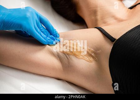 Master of sugaring making hair removal procedure for woman. Epilation with liquate sugar paste. Beautician waxing female armpit Stock Photo