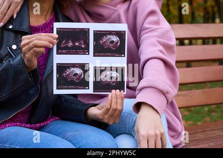 Woman with sonographic images sitting beside her partner in public park Stock Photo