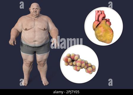 Cholesterol and fatty heart in overweight man, illustration Stock Photo