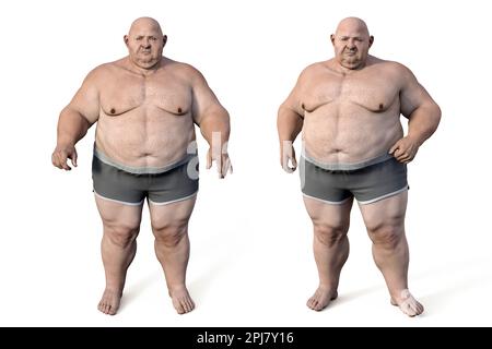 Obese man standing, illustration Stock Photo