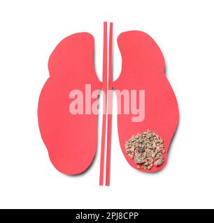 Paper cutout with stones on white background, top view. Kidney stone disease Stock Photo