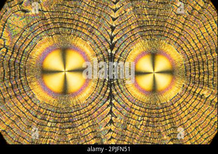 Vitamin C crystals, polarised light microscopy Stock Photo