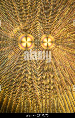 Vitamin C crystals, polarised light microscopy Stock Photo