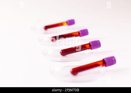 Row of blood sample tubes in petri dishes, on white background Stock ...