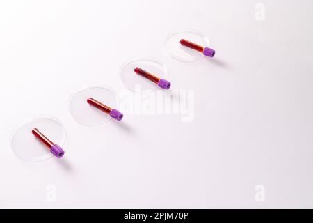 Test tubes and petri dishes with blood samples. DNA analysis concept ...
