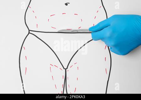 Doctor holding scalpel near drawn human body with marks on white background, top view. Weight loss surgery Stock Photo