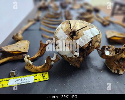 Manila, Philippines. 04th Apr, 2023. Forensic pathologist Dr. Raquel Fortun examines the exhumed skeletons of drug war victims in Caloocan City. (Photo by Sherbien Dacalanio/Pacific Press) Credit: Pacific Press Media Production Corp./Alamy Live News Stock Photo