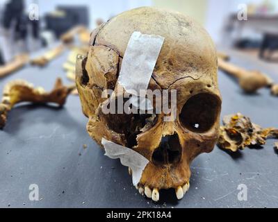 Manila, National Capital Region, Philippines. 4th Apr, 2023. Forensic pathologist Dr. Raquel Fortun examines the exhumed skeletons of drug war victims in Caloocan City. (Credit Image: © Sherbien Dacalanio/Pacific Press via ZUMA Press Wire) EDITORIAL USAGE ONLY! Not for Commercial USAGE! Stock Photo