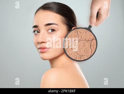 Young woman with facial dry skin problem on light grey background Stock Photo