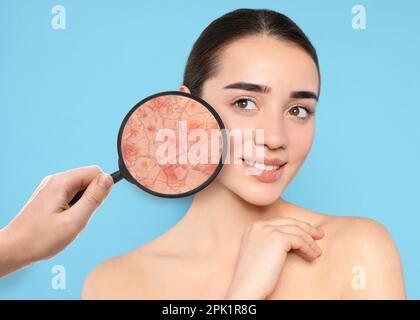 Young woman with facial dry skin problem on light blue background Stock Photo