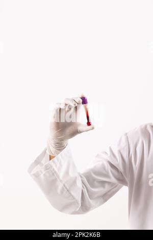 Hand in white surgical glove holding blood sample tube, on white background with copy space Stock Photo