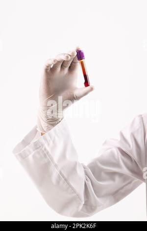 Hand in white surgical glove holding blood sample tube, on white background Stock Photo