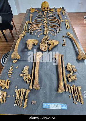 Manila, Philippines. 04th Apr, 2023. Forensic pathologist Dr. Raquel Fortun examines the exhumed skeletons of drug war victims in Caloocan City, in Metropolitan Manila, Philippines, on April 4, 2023. (Photo by Sherbien Dacalanio/Pacific Press/Sipa USA) Credit: Sipa USA/Alamy Live News Stock Photo