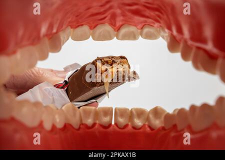 Decayed Sweets A bitten chocolate bar in a dental jaw mockup on a blue background. The ...