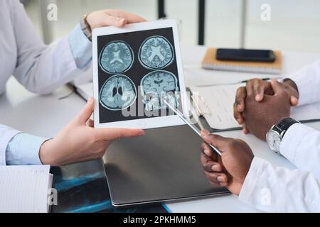 Close-up of group of doctors discussing brain tomography on digital tablet in team during meeting Stock Photo