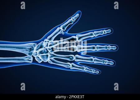 Metacarpal bones of right hand and wrist 3d illustration Stock Photo ...