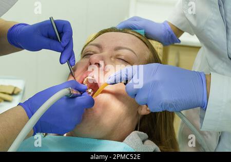 The dentist treats the teeth of the patient in the clinic. Close-up of the face, gloved hands, tools for dental treatment. Stock Photo