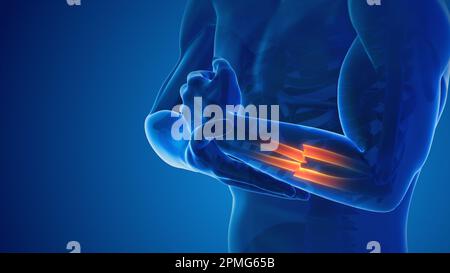 Broken hand bone pain medical concept Stock Photo