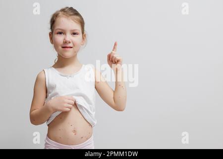 Little child with pimples of chickenpox pointing on copy space Stock Photo