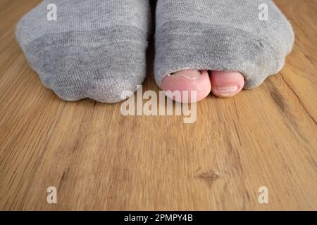 Worn out socks with holes and toes sticking out of them on old wooden floor  Stock Photo - Alamy