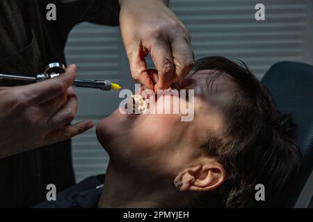 Dentist working with a patient in a dental office. The doctor makes an injection of anesthetic into the gum closeup Stock Photo