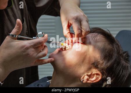 Dentist working with a patient in a dental office. The doctor makes an injection of anesthetic into the gum closeup Stock Photo