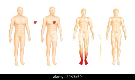 The nerves and the pain in the human body Stock Photo