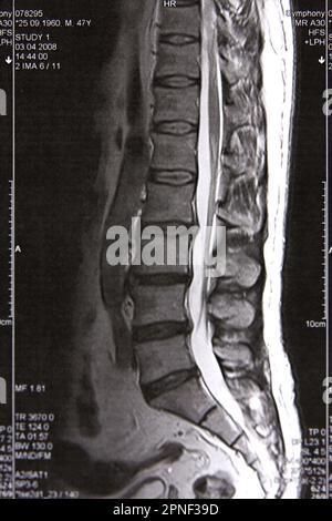 Nuclear Magnetic Resonance (NMR) image of a sagittal (mid-profile ...