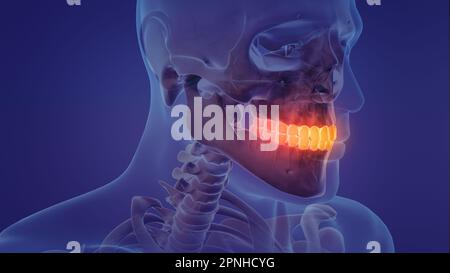 Animation of a painful teeth Stock Photo