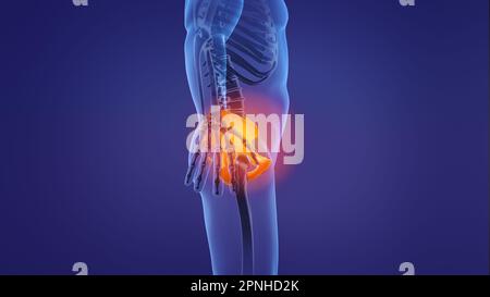 Animation of a painful pelvic girdle Stock Photo