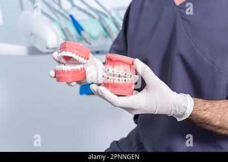 Crop unrecognizable male dentist in medical uniform and latex gloves showing dentures with vacuum formed retainer and braces while sitting in modern l Stock Photo