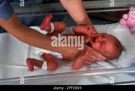 midwife performing newborn baby health checks, cleft palate Stock Photo