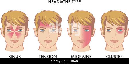 Illustration of types of headache Stock Vector