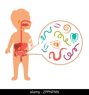 Vector Illustration of a kid Intestinal Parasites, worm disease Stock Vector