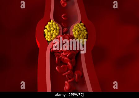 Low-density Lipoprotein (ldl) And High-density Lipoprotein (hdl 