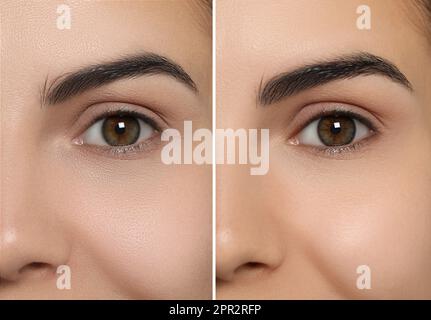 Collage with photos of woman having dry skin problem before and after moisturizing, closeup Stock Photo