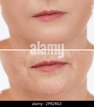 Collage with photos of mature woman having dry skin problem before and after moisturizing, closeup Stock Photo