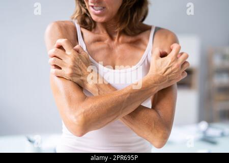 Woman With Itchy Skin Stock Photo