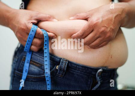 Overweight asian woman use hand to squeeze fat belly big size overweight and obesity. Stock Photo