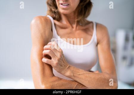 Woman With Itchy Skin Stock Photo