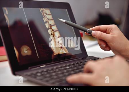 Doctor Pointing to X-ray Of Patient On Laptop Screen. Close Up Stock Photo