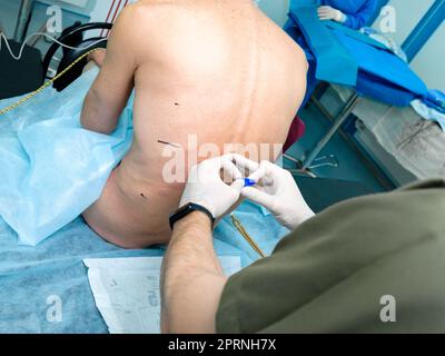 Injection of spinal anesthesia in preparation for surgery. The hands of ...