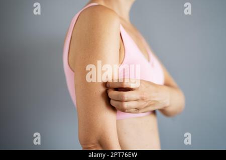 Scratching Itchy Skin. Sensitive Eczema Rash And Dermatitis Stock Photo