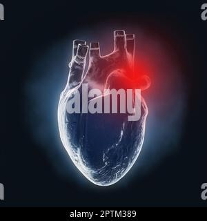 Human Heart Anatomy Internal Organ X-Ray Hologram View with Red Zone of Pain on a black background. 3d Rendering Stock Photo