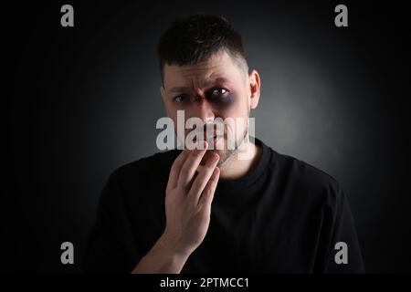 Man with facial injuries on dark background. Domestic violence victim Stock Photo