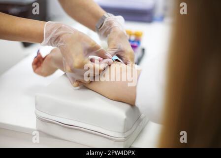 Young female patient during blood test sampling procedure. Close up Stock Photo
