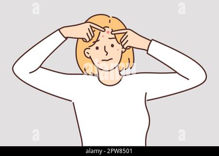 Woman with problem skin squeezes pimples from forehead in need of applying healing ointment Stock Vector