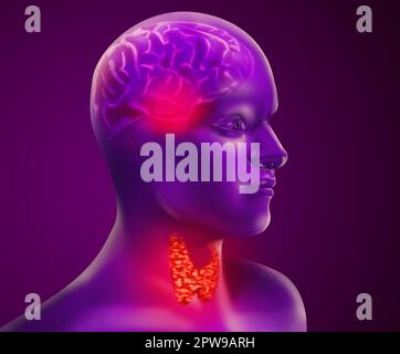 Illustration of human with inflamed thyroid gland on color background Stock Photo